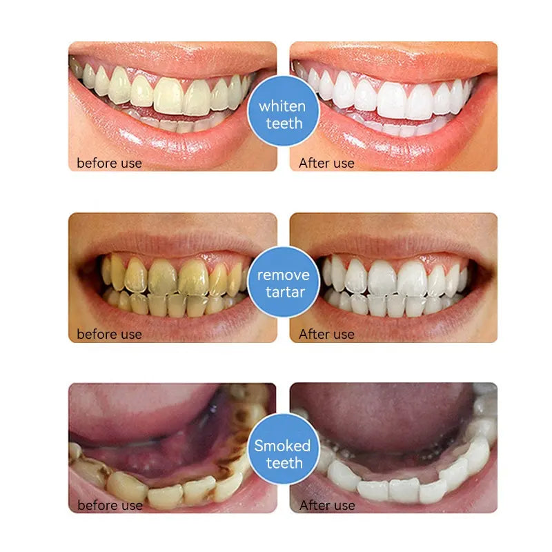 Hydroxyapatite Toothpaste - Buy 1 get 1 Free